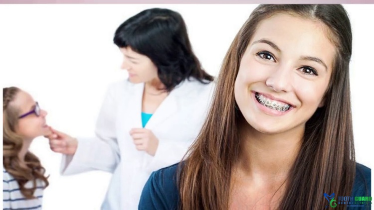 تركيب دعامات للاسنان